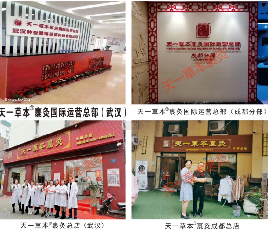 天一草本裹灸世代相傳 憑效果帶來驚喜