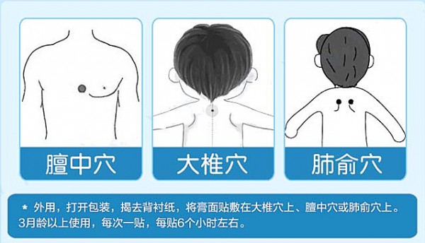 四季寶寶咳嗽拖不得 家中常備葵花童博士外用貼劑止咳貼